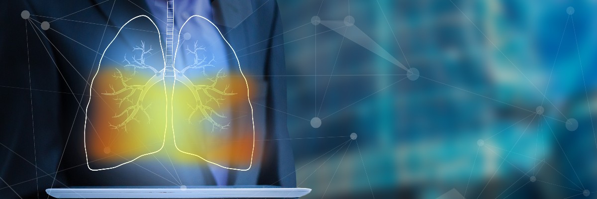 AI model uses serial imaging to predict lung cancer